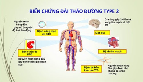 biến chứng của tiểu đường tuýp 2